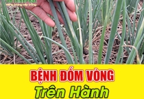 ĐỐM VÒNG HÀNH LÁ - CÁCH PHÒNG TRỊ HIỆU QUẢ 